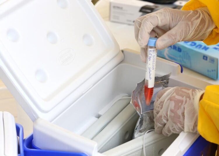 Aracaju registra primeiro caso de dupla infecção de coronavírus e influenza – ALERTA EPIDEMOLÓGICO