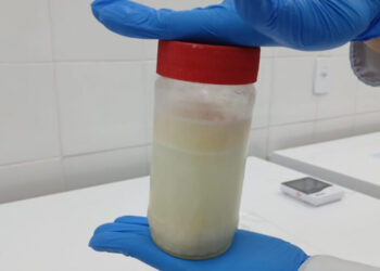 Leite doado ao Banco Marly Sarney já beneficiou mais de 800 bebês internados na maternidade Nossa Senhora de Lourdes