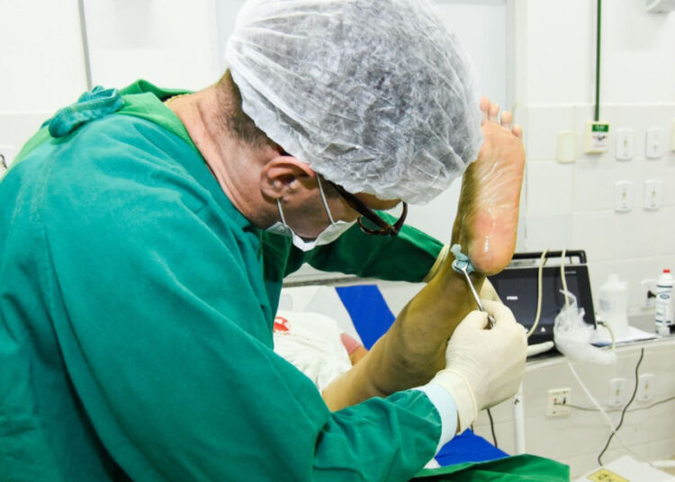 Governo do Estado realiza mutirão de cirurgias de varizes em São Cristóvão